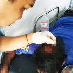 Diserang Pria Bertopeng, Petani di Situbondo Kepala Bocor Berdarah-Darah