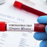 Hasil PCR, Pasien Positif Covid-19 di Banyuwangi Bertambah 7 Jadi 20 Orang
