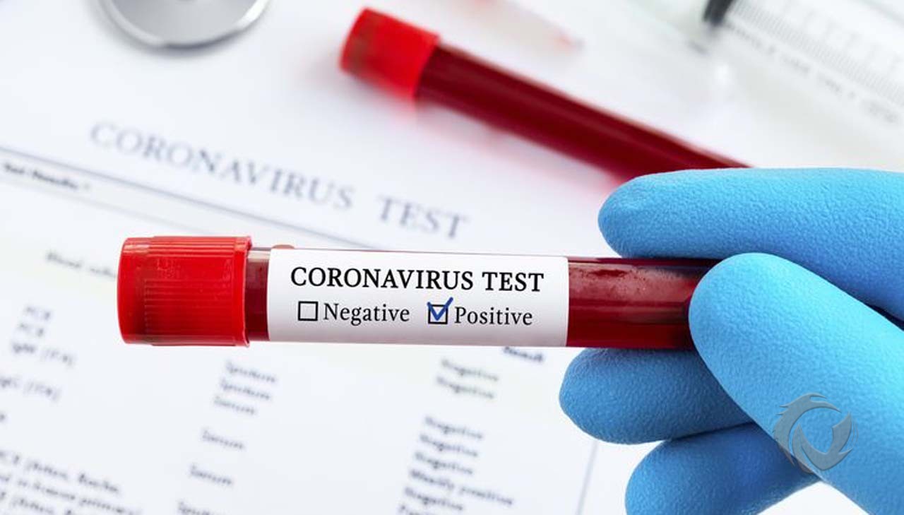 Hasil PCR, Pasien Positif Covid-19 di Banyuwangi Bertambah 7 Jadi 20 Orang