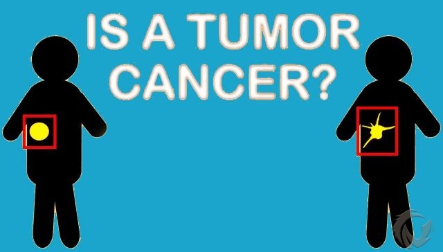 Mengenal Perbedaan Tumor dan Kanker