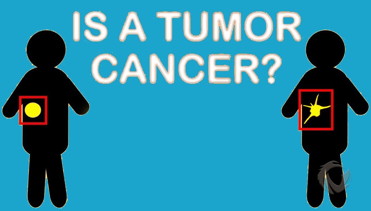 perbedaan tumor dan kanker