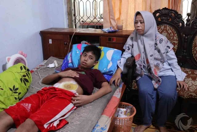 Kisah Pilu Bocah di Jombang, Operasi Usus Besar setelah Alat Vital Tertendang Sepupu