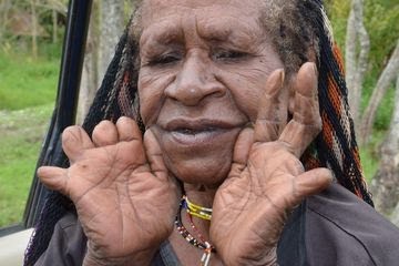 Ngeri, Suku di Papua Ini Punya Tradisi Potong Jari Saat Keluarganya Meninggal