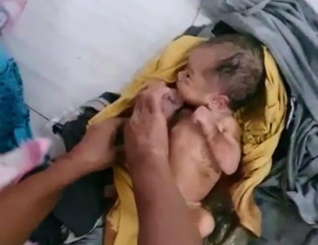 Heboh, Bayi Mungil Baru Lahir Ditemukan di Selokan di Bondowoso