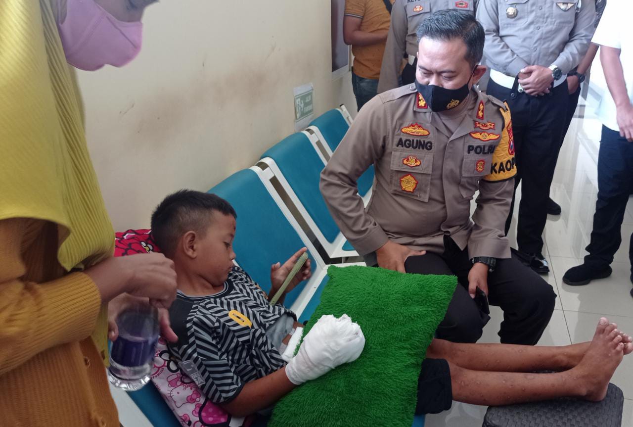 Kapolres Kediri Jenguk Bocah Korban Ledakan Petasan