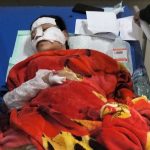 Membetulkan LPG Bocor, Lima Perempuan di Pasuruan Terbakar