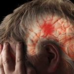 Cara Cegah Stroke dengan Mengendalikan Faktor Risikonya