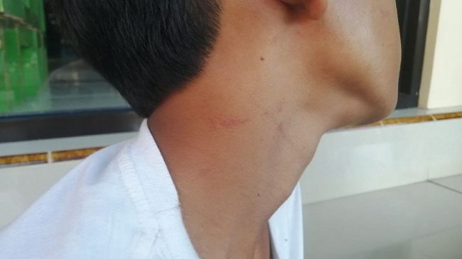 Oknum Polisi di Situbondo Diduga Tendang dan Injak-injak Anak di Bawah Umur